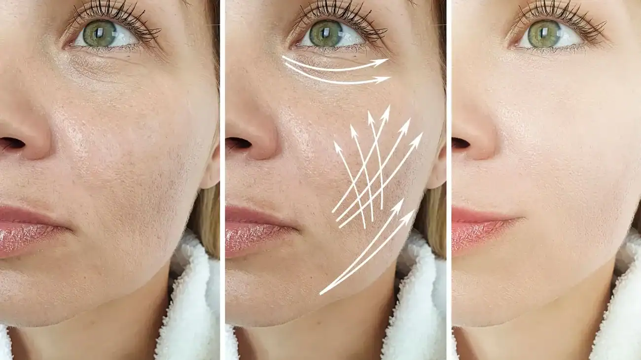 Can One Treatment Really Tackle More Than One Skin Concern Selston?