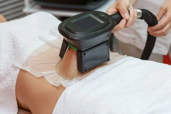 Image of person having fat freezing treatment to help weight gain Selston