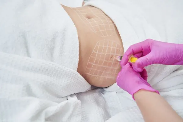 image of fat dissolving injections on love handles to help combat weight gain Selston