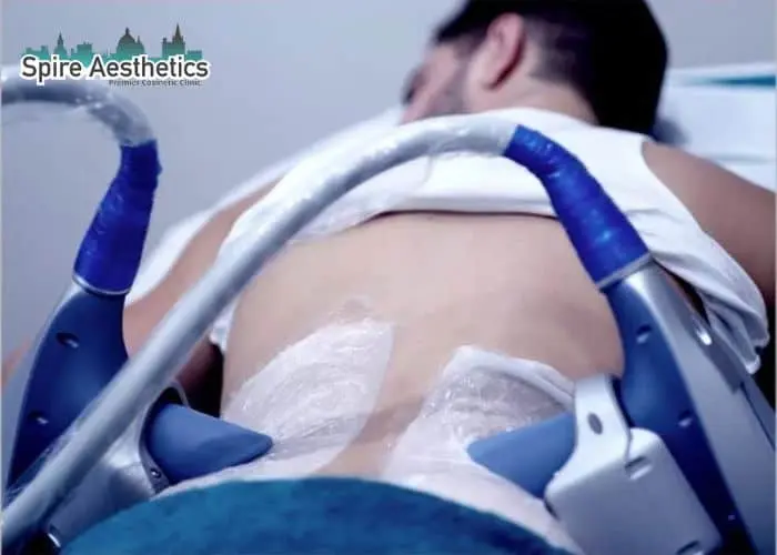 Man having fat freezing treatment done on love handles before a competitions Selston to create a sculpted look.