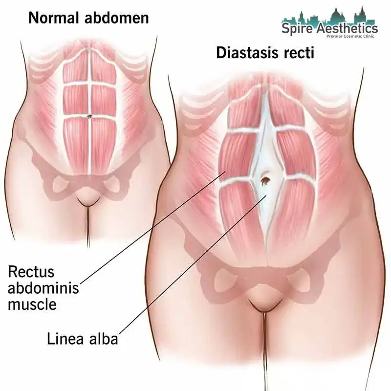 When Will My Belly Feel Normal Again Selston?