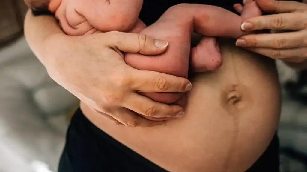 Why Is My Stomach Still Big After Pregnancy Selston?